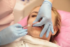 Hyaluronic Acid on lips